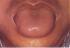 Diagnóstico por la forma de la lengua